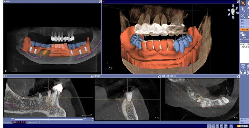 3D CT 기반 모의수술